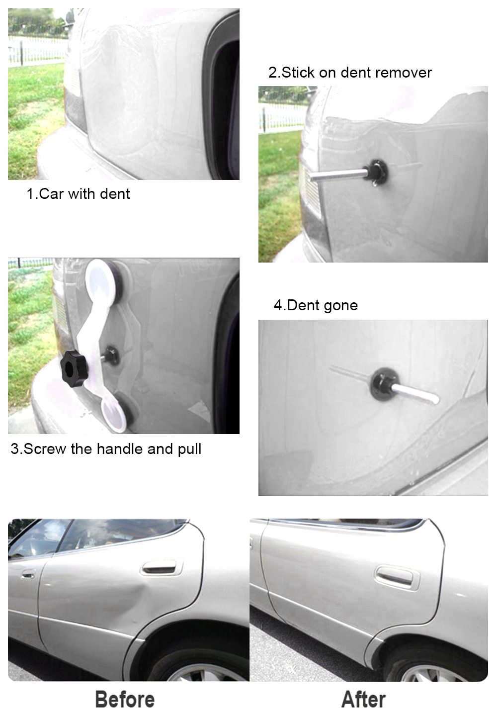 White Bridge Dent Puller Kit For Car Dent Repair Pops A Dent Tools Operation